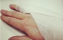 руки