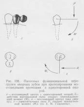 протезиране