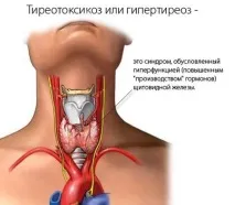 Постійна спрага – причини, ознаки та лікування ознаки