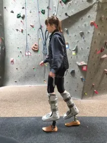 Придуманий та розроблений протез у якому можна ходити на підборах якому
