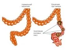 Чим лікувати геморойні шишки шишки