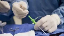 Стентування судин серця тривалість життя після коронарної операції - Інфо стентування