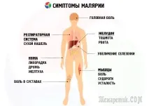 Тропічна малярія симптоми тропічна