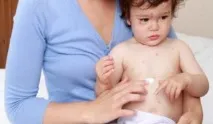 Вітрянка у дітей симптоми та лікування в домашніх умовах, поради Комаровського вітрянка