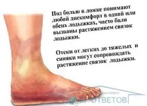 Можливі причини болю в кісточках -відповіді та поради на твої запитання кісточках