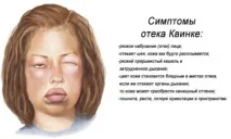 Цинкова мазь при геморої склад, інструкція із застосування, протипоказання, відгуки, ціни склад