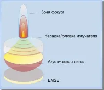 ударної хвилі