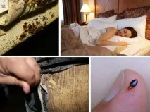 Домашні клопи – найефективніші методи боротьби! Фото приклади та відео! домашні