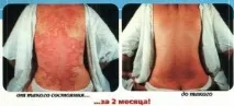 пациенти диета