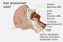 Як позбутися хропіння, Журнал Домівка позбутися