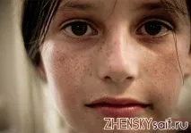 Як позбутися ластовиння в домашніх умовах, боремося з ластовинням умовах