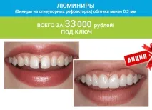 стоматология естетика