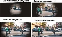 Лікування глаукоми народними засобами та вправами засобами