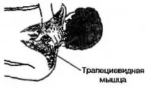 Мануальна терапія та медичний масаж живота при болях у сідничному нерві масаж