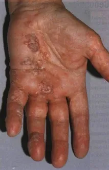 MY DERMATOLOGY dermatology
