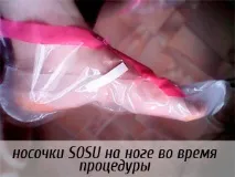 Педикюрні шкарпетки SOSU для профілактики діабетичної стопи у хворих на цукровий діабет шкарпетки