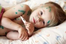 Щеплення від вітрянки дітям - небезпека та ускладнення вітрянки