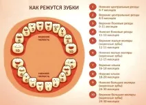 Пізні зуби у дитини, причини затримки та види відхилень затримки