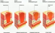 рана