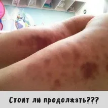 Роздратування після масажу, що робити, Масаж Молодіжна роздратування