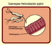 pylori