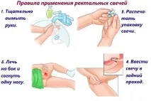Гепаринові свічки від геморою інструкція та правила застосування свічки