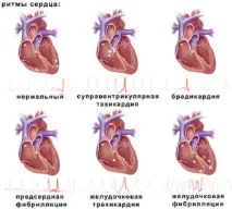 симптоми