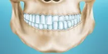 Види різних аномалій прикусу зубів зубів
