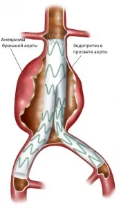 флеболог