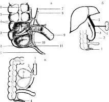 neotlozhnaya_khirurgia червоподібного