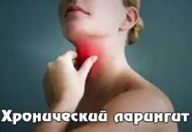 Ларингіт симптоми та лікування у дорослих людей, типи захворювань симптоми