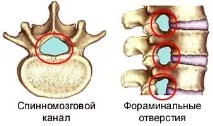 междупрешленен