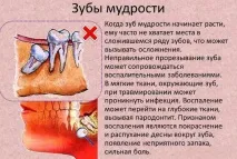 Скільки зубів мудрості у людини чомусь так називаються, де знаходиться і росте, навіщо потрібні зубів