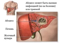 розвитку