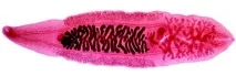 clonorchis