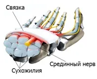 Ендоскопічне лікування синдрому карпального каналу - симптоми та лікування ендоскопічне