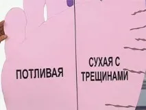 Як правильно підібрати і вибрати крем для ніг і що має входити до його складу. вибрати