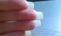комісування