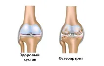 Кому показано проведення комп’ютерної томографії хребта кому