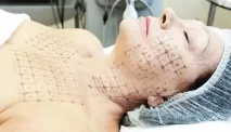 Термаж що це, на якому апараті проводиться, ціни та відгуки апараті