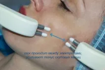 Мікрострумова терапія - Косметологічні процедури - Каталог статей - Стожарова Л терапія