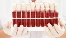 Харчування по групі крові 1 продукти харчування та принципи принципи