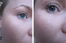 Пудра MAC Studio Fix powder plus foundation nw25 відгуки відгуки