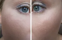 Пудра MAC Studio Fix powder plus foundation nw25 відгуки nw25