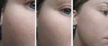 Пудра MAC Studio Fix powder plus foundation nw25 відгуки відгуки