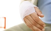 Розробка руки після перелому розробка