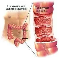 приховані