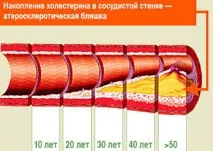 Старовинний рецепт очищення судин від холестерину холестерину