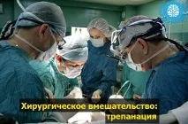 Видалення пухлини головного мозку видалення