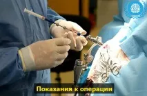 Видалення пухлини головного мозку головного